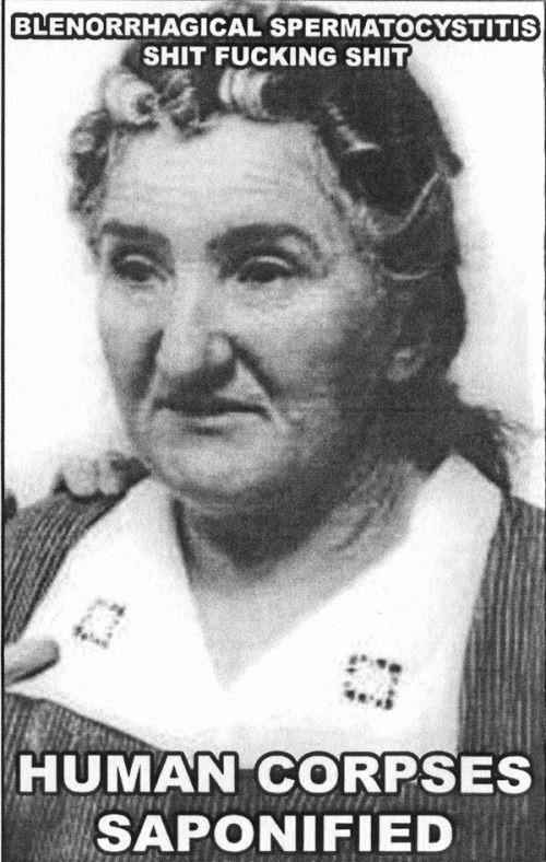 Blenorrhagical Spermatocystitis : Human Corpses Saponified